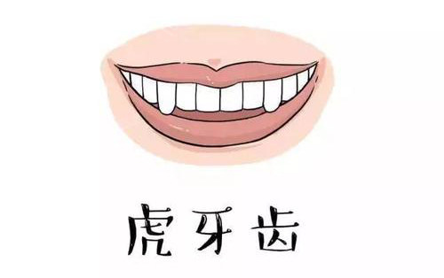 注意虎牙可能潜伏有隐患