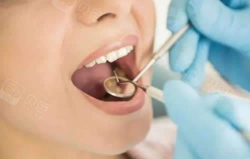 北京东城区哪些口腔医院看牙技术好,口碑也不错,做牙齿治疗一般怎么