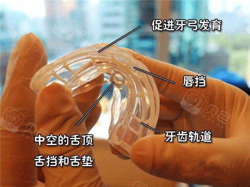 儿童eta矫正器图解