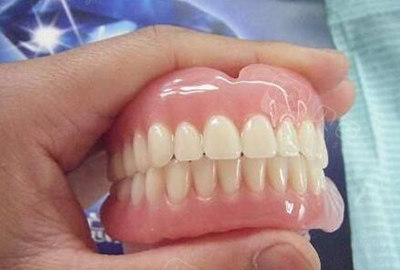 上海镶满口牙的价格是多少不同材料做全口种植牙价格公布