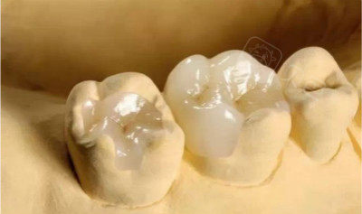 牙齿大面积龋坏,是直接拔掉还是嵌体修复或者做牙冠呢?