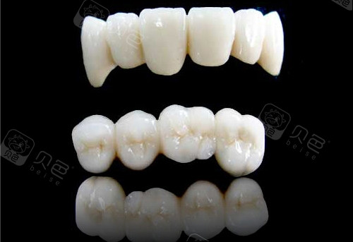 二氧化锆全瓷牙