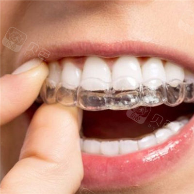 医生推荐的隐适美和钢牙套哪个矫正好?其实各有优势!