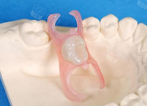 珠海镶牙医院哪里比较好在珠海镶牙多少钱一个