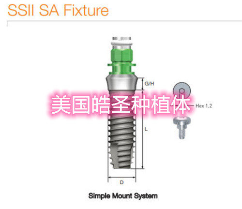价格参考:8000元左右/颗植体优势:美国皓圣种植体的稳定性非常好,寿命
