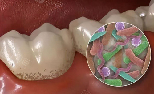 分析牙菌斑形成过程
