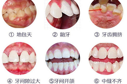推荐牙齿矫正医院排行名单!