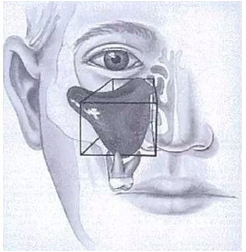 分享种牙上颌窦提升全过程!