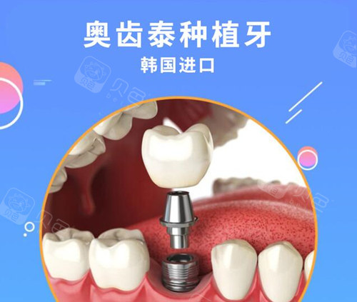 韩国奥齿泰种植牙