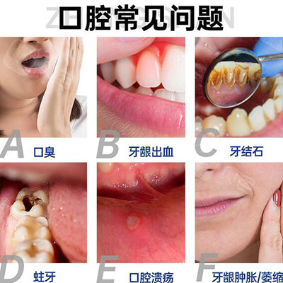 口腔常见的问题有哪些
