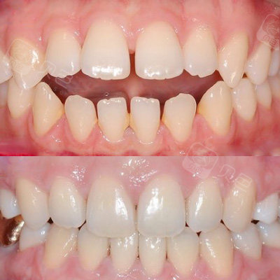 盘点邢台整牙,正畸好的牙科医院