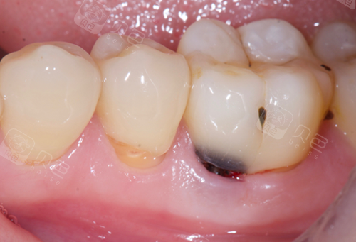 在梁溪给孩子看牙被骗他们都说应该去无锡维乐或美奥