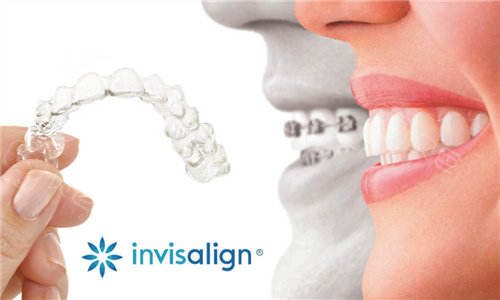 想在北京做隐形矫正,时代天使牙套和隐适美知道怎么选吗?