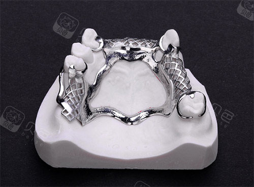 纯钛活动假牙图片