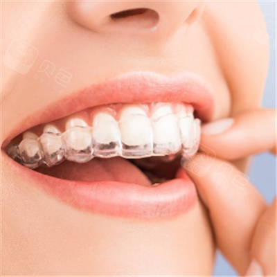 隐形矫正牙套