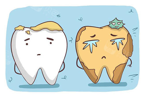 牙齿损坏示意图