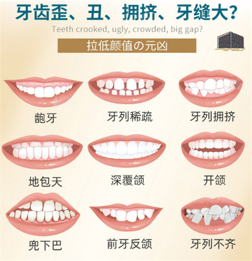 苏州口腔医院牙套价格,公布苏州口腔医院矫正牙齿费用!