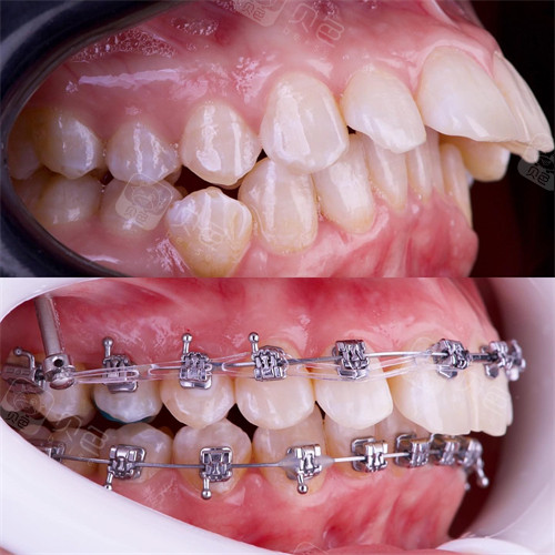 武汉大众口腔正畸