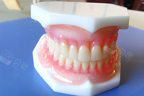 假牙模型图