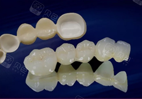 全瓷牙冠价格表2021新版,揭秘做一个全瓷牙套多少钱!