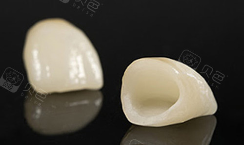 你知道厦门全瓷牙多少钱一颗吗?带你了解厦门全瓷牙价格!