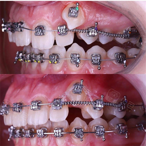 正畸性就比超高的5家医院不来看看