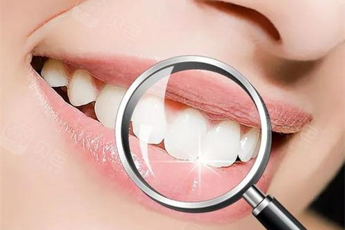 健康整齐的牙齿