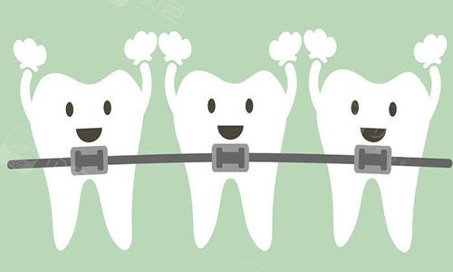 牙齿矫正卡通图
