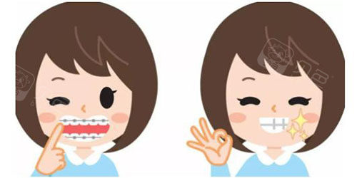 如果牙齿有牙缝过多,或者是牙齿排列不齐等问题,建议优先考虑正畸的