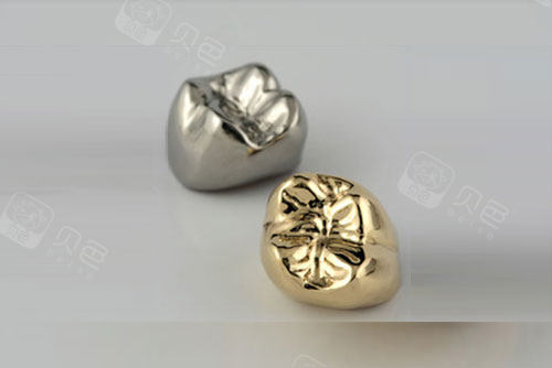 所以他的牙冠就选的是金属冠,虽然我想让他选全瓷冠,但是医生说要是崩