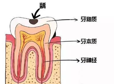 龙岩补牙哪里好来这家补完牙齿就能咬苹果很厉害