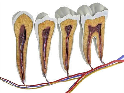 根管治疗切断牙神经