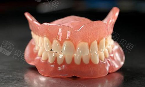 全口吸附性义齿