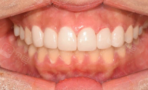 名气指数:4颗星擅长项目:牙齿美学修复基本背景情况:瑞柏口腔是一家