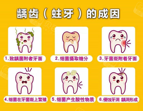 听说济宁补牙只要100块钱这样的补牙材料能结实吗