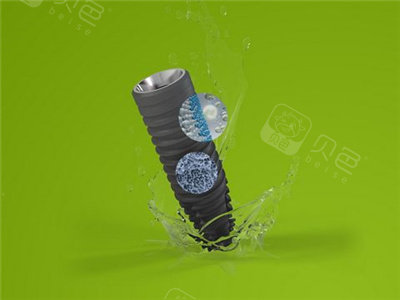 士卓曼iti亲水种植牙