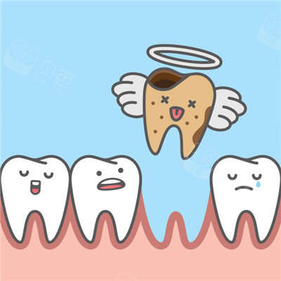 广州90后土著现身说法告诉你缺牙好几年还能种牙吗