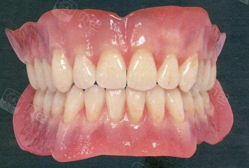 深度点评正睿口腔种植牙好吗?正睿种植名医不止赵医生!