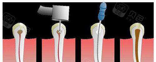牙科怎么治疗牙齿松动怎么办？重庆牙科医院牙齿松动的治疗方法有哪些_https://www.jmylbn.com_新闻资讯_第5张