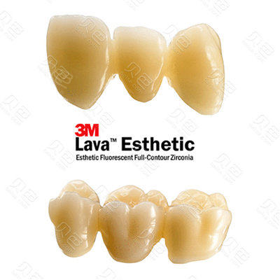 procera和lava,都是更有针对性的全瓷牙品牌,相对来说lava把产品线铺