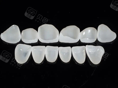 牙齿贴面美白要多少钱贵阳利美康牙贴面材料种类及价格