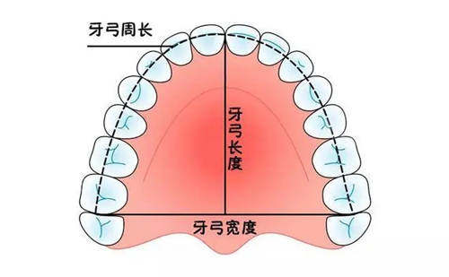 牙齿正畸拔牙四个收缝要多久亲身经历告诉你正畸收缝时间
