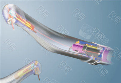 口腔激光怎么治疗水激光牙周治疗有用吗？这种新科技可以做很多口腔治疗!_https://www.jmylbn.com_新闻资讯_第3张