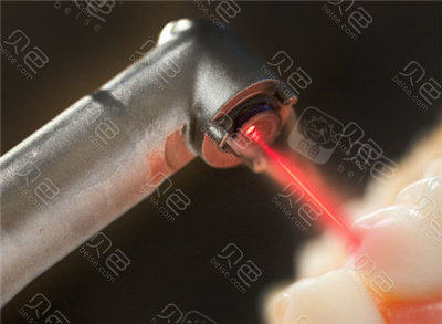 口腔激光怎么治疗水激光牙周治疗有用吗？这种新科技可以做很多口腔治疗!_https://www.jmylbn.com_新闻资讯_第5张