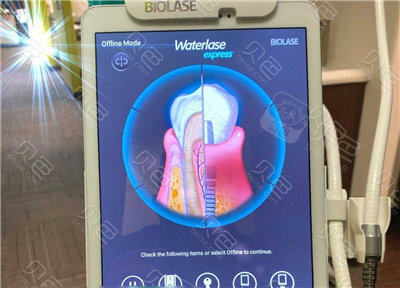 口腔激光怎么治疗水激光牙周治疗有用吗？这种新科技可以做很多口腔治疗!_https://www.jmylbn.com_新闻资讯_第7张