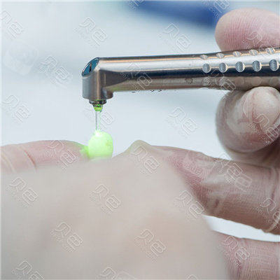 口腔激光怎么治疗水激光牙周治疗有用吗？这种新科技可以做很多口腔治疗!_https://www.jmylbn.com_新闻资讯_第6张