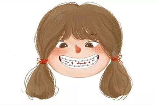 威海隐形矫正牙齿的费用是多少做隐形矫正哪家比较好