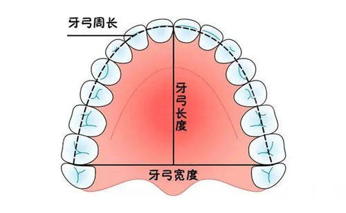 像矫正不拔牙能矫正过来吗