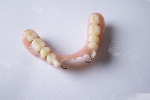 什么叫无挂钩假牙?和种植牙是一回事吗?挂钩vs不挂钩哪个好?