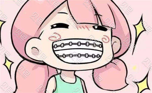 牙齿矫正卡通图